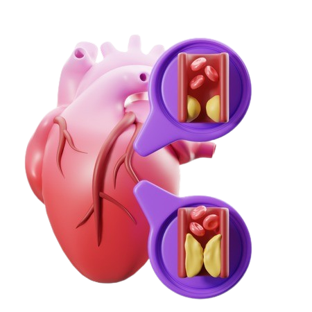 coronary angiography removebg preview